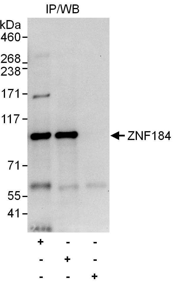 Immunoprecipitation:[NBP3-30110]-Detection of human ZNF184 by western blot of immunoprecipitates. Samples: Whole cell lysate from Jurkat cells. Antibodies: Affinity purified rabbit anti-ZNF184 antibody used for IP at 6 µg/mg lysate. ZNF184 was also immunoprecipitated by rabbit anti-ZNF184 antibody , which recognizes an upstream epitope. For blotting immunoprecipitated ZNF184, was used at 1 µg/ml. Detection: Chemiluminescence with exposure times of 30 seconds and 10 seconds.