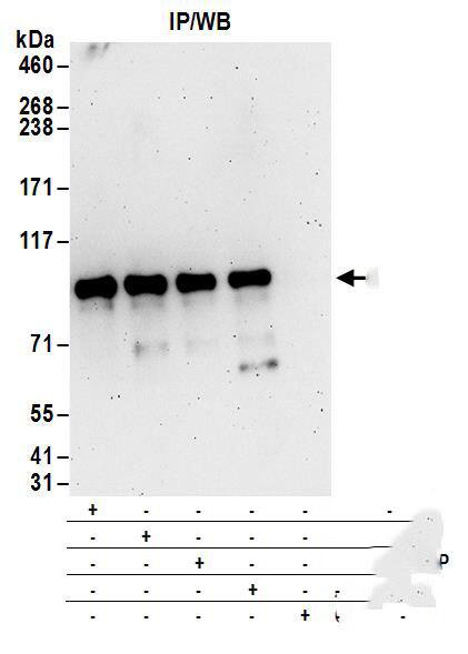 Immunoprecipitation:[NBP3-30111]-Detection of human DIXDC1 by western blot of immunoprecipitates. Samples: Whole cell lysate from 293T cells. Antibodies: Affinity purified rabbit anti-DIXDC1 antibody used for IP at 6 µg/mg lysate. DIXDC1 was also immunoprecipitated by rabbit anti-DIXDC1 antibodies , and. For blotting immunoprecipitated DIXDC1, was used at 1 µg/ml. Detection: Chemiluminescence with an exposure time of 3 minutes.