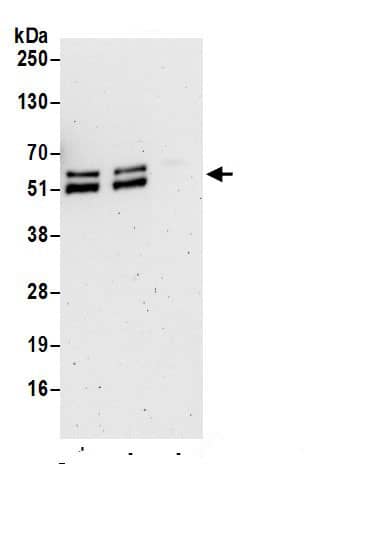 Immunoprecipitation:PPAR gamma/NR1C3 AntibodyNBP3-30113] -Detection of mouse PPAR-gamma by western blot of immunoprecipitates. Samples: Whole cell lysate (1 mg for IP; 20% of IP loaded) from differentiated mouse NIH 3T3-L1 cells prepared using NETN lysis buffer. Antibodies: Affinity purified rabbit anti-PPAR-gamma antibody NBP3-30113 (lot NBP3-30113-1) used for IP at 6 µg per reaction. PPAR-gamma was also immunoprecipitated by rabbit anti-PPAR-gamma.. For blotting immunoprecipitated PPAR-gamma, NBP3-30113 was used at 0.1 µg/ml. Detection: Chemiluminescence with an exposure time of 3 minutes.