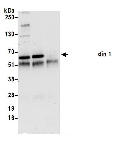 Immunoprecipitation:Nucleobindin 1 AntibodyNBP3-30115] -Detection of human Nucleobindin 1 by western blot of immunoprecipitates. Samples: Whole cell lysate (0.5 or 1.0 mg per IP reaction; 20% of IP loaded) from 293T cells prepared using NETN lysis buffer. Antibody: Affinity purified rabbit anti-Nucleobindin 1 antibody NBP3-30115 (lot NBP3-30115-1) used for IP at 6 µg per reaction. Nucleobindin 1 was also immunoprecipitated by rabbit anti-Nucleobindin 1.. For blotting immunoprecipitated Nucleobindin 1, NBP3-30115 was used at 1 µg/ml. Detection: Chemiluminescence with an exposure time of 30 seconds.