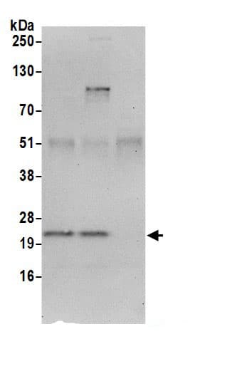 Immunoprecipitation:MRPS23 AntibodyNBP3-30117] -Detection of human MRPS23 by western blot of immunoprecipitates. Samples: Whole cell lysate (0.5 or 1.0 mg per IP reaction; 20% of IP loaded) from 293T cells prepared using NETN lysis buffer. Antibodies: Affinity purified rabbit anti-MRPS23 antibody NBP3-30117 (lot NBP3-30117-1) used for IP at 6 µg per reaction. MRPS23 was also immunoprecipitated by rabbit anti-MRPS23.. For blotting immunoprecipitated MRPS23, A305-131A was used at 0.4 µg/ml. Detection: Chemiluminescence with an exposure time of 30 seconds.