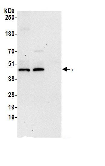 Immunoprecipitation:FDFT1 AntibodyNBP3-30119] -Detection of human FDFT1 by western blot of immunoprecipitates. Samples: Whole cell lysate (0.5 or 1.0 mg per IP reaction; 20% of IP loaded) from 293T cells prepared using NETN lysis buffer. Antibodies: Affinity purified rabbit anti-FDFT1 antibody NBP3-30119 (lot NBP3-30119-1) used for IP at 6 µg per reaction. FDFT1 was also immunoprecipitated by rabbit anti-FDFT1.. For blotting immunoprecipitated FDFT1, NBP3-30119 was used at 0.4 µg/ml. Detection: Chemiluminescence with an exposure time of 30 seconds.