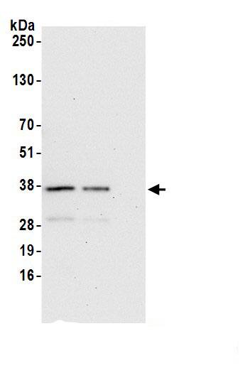 Immunoprecipitation:STX17 AntibodyNBP3-30120] -Detection of human STX17 by western blot of immunoprecipitates. Samples: Whole cell lysate (1.0 mg per IP reaction; 20% of IP loaded) from 293T cells prepared using NETN lysis buffer. Antibodies: Affinity purified rabbit anti-STX17 antibody (NBP3-30120 lot 1) used for IP at 6 µg per reaction. STX17 was also immunoprecipitated by rabbit anti-STX17.. For blotting immunoprecipitated STX17, NBP3-30120 was used at 0.4 mg/ml. Detection: Chemiluminescence with an exposure time of 30 seconds.