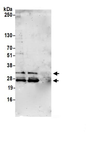 Immunoprecipitation:MEA-1 AntibodyNBP3-30121] -Detection of human MEA1 by western blot of immunoprecipitates. Samples: Whole cell lysate (1.0 mg per IP reaction; 20% of IP loaded) from HeLa cells prepared using NETN lysis buffer. Antibodies: Affinity purified rabbit anti-MEA1 antibody (NBP3-30121 lot 1) used for IP at 6 µg per reaction. MEA1 was also immunoprecipitated by rabbit anti-MEA1.. For blotting immunoprecipitated MEA1, NBP3-30121 was used at 0.4 mg/ml. Detection: Chemiluminescence with an exposure time of 75 seconds.