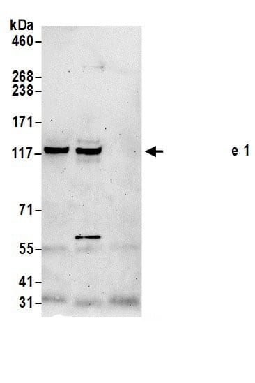 Immunoprecipitation:FMNL1 AntibodyNBP3-30122] -Detection of human Formin-like 1 by western blot of immunoprecipitates. Samples: Whole cell lysate (0.5 or 1.0 mg per IP reaction; 20% of IP loaded) from HeLa cells prepared using NETN lysis buffer. Antibody: Affinity purified rabbit anti-Formin-like 1 antibody NBP3-30122 (lot NBP3-30122-1) used for IP at 6 µg per reaction. Formin-like 1 was also immunoprecipitated by rabbit anti-Formin-like 1 antibody. For blotting immunoprecipitated Formin-like 1, NBP3-30122 was used at 1 µg/ml. Detection: Chemiluminescence with an exposure time of 3 minutes.