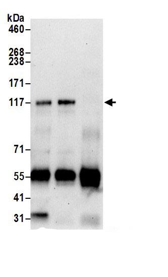 Immunoprecipitation:MSH3 AntibodyNBP3-30123] -Detection of human MSH3 by western blot of immunoprecipitates. Samples: Whole cell lysate (0.5 or 1.0 mg per IP reaction; 20% of IP loaded) from HeLa cells prepared using NETN lysis buffer. Antibodies: Affinity purified rabbit anti-MSH3 antibody NBP3-30123 (lot NBP3-30123-1) used for IP at 6 µg per reaction. MSH3 was also immunoprecipitated by rabbit anti-MSH3.. For blotting immunoprecipitated MSH3, NBP3-30123 was used at 1 µg/ml. Detection: Chemiluminescence with an exposure time of 30 seconds.