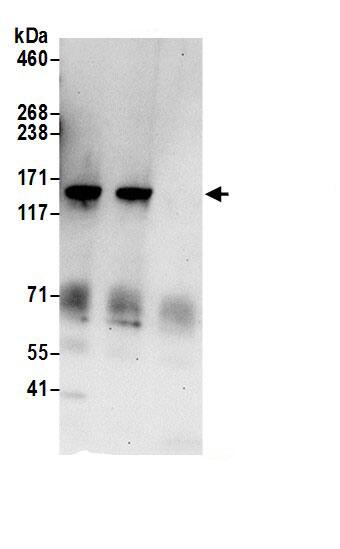 Immunoprecipitation:TBC1D9B AntibodyNBP3-30124] -Detection of human TBC1D9B by western blot of immunoprecipitates. Samples: Whole cell lysate (0.5 or 1.0 mg per IP reaction; 20% of IP loaded) from 293T cells prepared using NETN lysis buffer. Antibodies: Affinity purified rabbit anti-TBC1D9B antibody NBP3-30124 (lot NBP3-30124-1) used for IP at 6 µg per reaction. TBC1D9B was also immunoprecipitated by rabbit anti-TBC1D9B.. For blotting immunoprecipitated TBC1D9B, NBP3-30124 was used at 1 µg/ml. Detection: Chemiluminescence with an exposure time of 30 seconds.