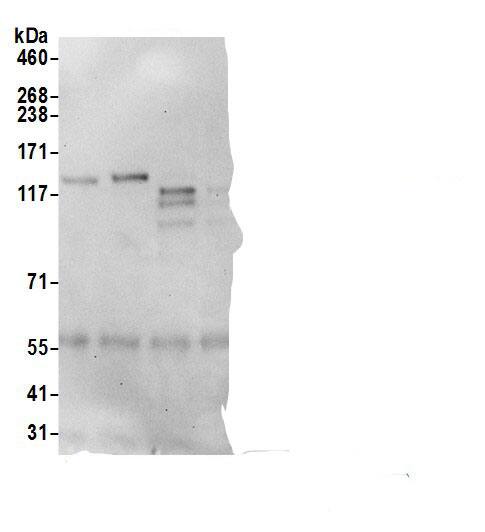 Immunoprecipitation:CDAN1 AntibodyNBP3-30125] -Detection of human Codanin 1/CDAN1 by western blot of immunoprecipitates. Samples: Whole cell lysate (0.5 or 1.0 mg per IP reaction; 20% of IP loaded) from HeLa, HEK293T, Jurkat, and mouse NIH 3T3 cells prepared using NETN lysis buffer. Antibodies: Affinity purified rabbit anti-Codanin 1/CDAN1 antibody NBP3-30125 (lot NBP3-30125-1) used for IP at 6 µg per reaction. For blotting immunoprecipitated Codanin 1/CDAN1, A304-952A was used at 1 µg/ml. Detection: Chemiluminescence with an exposure time of 30 seconds.