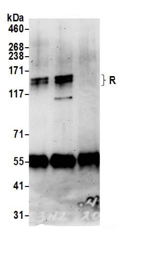 Immunoprecipitation:MNAB AntibodyNBP3-30127] -Detection of human RC3H2 by western blot of immunoprecipitates. Samples: Whole cell lysate (0.5 or 1.0 mg per IP reaction; 20% of IP loaded) from HeLa cells prepared using NETN lysis buffer. Antibodies: Affinity purified rabbit anti-RC3H2 antibody NBP3-30127 (lot NBP3-30127-1) used for IP at 6 µg per reaction. RC3H2 was also immunoprecipitated by rabbit anti-RC3H2.. For blotting immunoprecipitated RC3H2, NBP3-30127 was used at 0.4 µg/ml. Detection: Chemiluminescence with an exposure time of 3 minutes.