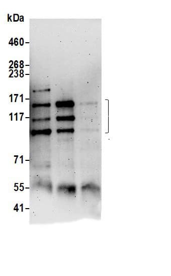 Immunoprecipitation:PEX1 AntibodyNBP3-30128] -Detection of human PEX1 by western blot of immunoprecipitates. Samples: Whole cell lysate (0.5 or 1.0 mg per IP reaction; 20% of IP loaded) from Jurkat cells prepared using NETN lysis buffer. Antibodies: Affinity purified rabbit anti-PEX1 antibody NBP3-30128 (lot NBP3-30128-1) used for IP at 6 µg per reaction. PEX1 was also immunoprecipitated by rabbit anti-PEX1.. For blotting immunoprecipitated PEX1, NBP3-30128 was used at 1 µg/ml. Detection: Chemiluminescence with an exposure time of 3 minutes.