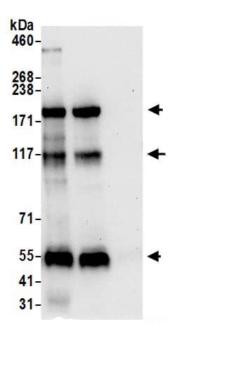 Immunoprecipitation:NISCH AntibodyNBP3-30129] -Detection of human NISCH by western blot of immunoprecipitates. Samples: Whole cell lysate (0.5 or 1.0 mg per IP reaction; 20% of IP loaded) from Jurkat cells prepared using NETN lysis buffer. Antibodies: Affinity purified rabbit anti-NISCH antibody NBP3-30129 (lot NBP3-30129-1) used for IP at 6 µg per reaction. NISCH was also immunoprecipitated by rabbit anti-NISCH antibody BL21611. For blotting immunoprecipitated NISCH, NBP3-30129 was used at 0.4 µg/ml. Detection: Chemiluminescence with an exposure time of 30 seconds.