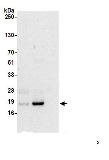Immunoprecipitation:RPP20 AntibodyNBP3-30131] -Detection of human POP5 by western blot of immunoprecipitates. Samples: Whole cell lysate (1.0 mg per IP reaction; 20% of IP loaded) from HeLa cells prepared using NETN lysis buffer. Antibodies: Affinity purified rabbit anti-POP5 antibody (NBP3-30131 lot 1) used for IP at 6 µg per reaction. POP5 was also immunoprecipitated by rabbit anti-POP5 antibody . For blotting immunoprecipitated POP5, NBP3-30131 was used at 0.4 mg/ml. Detection: Chemiluminescence with an exposure time of 30 seconds.