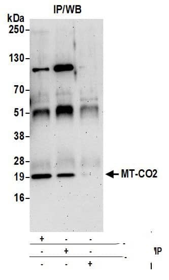 Immunoprecipitation:[NBP3-30144]-Detection of human MT-CO2 by western blot of immunoprecipitates. Samples: Whole cell lysate from Hep-G2cells prepared using NETN lysis buffer. Antibodies: Affinity purified rabbit anti-MT-CO2 antibody used for IP at 6 µg per reaction. MT-CO2 was also immunoprecipitated by rabbit anti-MT-CO2 antibody. For blotting immunoprecipitated MT-CO2, was used at 1 µg/ml. Detection: Chemiluminescence with an exposure time of 3 minutes.