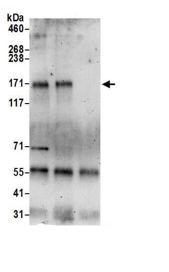 Immunoprecipitation ZNF532 Antibody - BSA Free