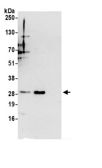 Immunoprecipitation:ETFB AntibodyNBP3-30146] -Detection of human ETFB by western blot of immunoprecipitates. Samples: Whole cell lysate (0.5 or 1.0 mg per IP reaction; 20% of IP loaded) from 293T cells prepared using NETN lysis buffer. Antibodies: Affinity purified rabbit anti-ETFB antibody NBP3-30146 (lot NBP3-30146-1) used for IP at 6 µg per reaction. ETFB was also immunoprecipitated by rabbit anti-ETFB.. For blotting immunoprecipitated ETFB, NBP3-30146 was used at 0.4 µg/ml. Detection: Chemiluminescence with an exposure time of 30 seconds.