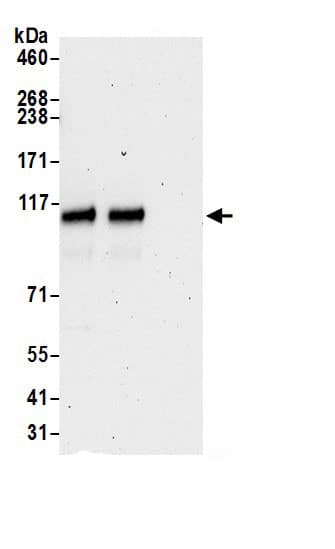 Immunoprecipitation:LIV-1/Zip6 AntibodyNBP3-30147] -Detection of human SLC39A6 by western blot of immunoprecipitates. Samples: Whole cell lysate (0.5 or 1.0 mg per IP reaction; 20% of IP loaded) from HeLa cells prepared using NETN lysis buffer. Antibodies: Affinity purified rabbit anti-SLC39A6 antibody NBP3-30147 (lot NBP3-30147-1) used for IP at 6 µg per reaction. SLC39A6 was also immunoprecipitated by rabbit anti-SLC39A6.. For blotting immunoprecipitated SLC39A6, NBP3-30147 was used at 0.4 µg/ml. Detection: Chemiluminescence with an exposure time of 75 seconds.