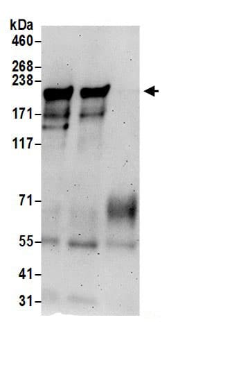 Immunoprecipitation:SIPA1L2 AntibodyNBP3-30149] -Detection of human SIPA1L2 by western blot of immunoprecipitates. Samples: Whole cell lysate (0.5 or 1.0 mg per IP reaction; 20% of IP loaded) from Jurkat cells prepared using NETN lysis buffer. Antibodies: Affinity purified rabbit anti-SIPA1L2 antibody NBP3-30149 (lot NBP3-30149-1) used for IP at 6 µg per reaction. SIPA1L2 was also immunoprecipitated by rabbit anti-SIPA1L2 antibody for blotting immunoprecipitated SIPA1L2, NBP3-30149 was used at 0.4 µg/ml. Detection: Chemiluminescence with an exposure time of 3 minutes.