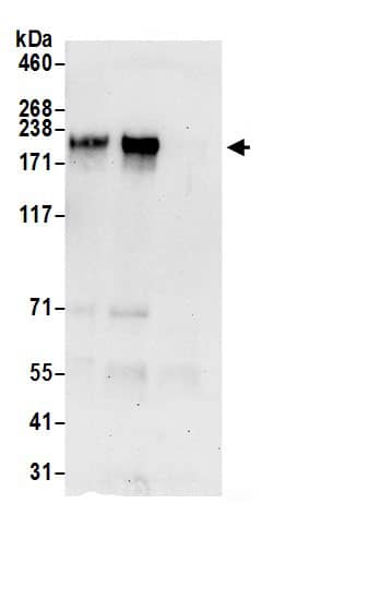 Immunoprecipitation:NFAT5 AntibodyNBP3-30150] -Detection of human NFAT5 by western blot of immunoprecipitates. Samples: Whole cell lysate (0.5 or 1.0 mg per IP reaction; 20% of IP loaded) from HeLa cells prepared using NETN lysis buffer. Antibodies: Affinity purified rabbit anti-NFAT5 antibody NBP3-30150 (lot NBP3-30150-1) used for IP at 6 µg per reaction. NFAT5 was also immunoprecipitated by rabbit anti-NFAT5.. For blotting immunoprecipitated NFAT5, NBP3-30150 was used at 1 µg/ml. Detection: Chemiluminescence with an exposure time of 30 seconds.