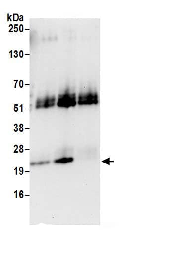 Immunoprecipitation:Apc10 AntibodyNBP3-30151] -Detection of human ANAPC10 by western blot of immunoprecipitates. Samples: Whole cell lysate (0.5 or 1.0 mg per IP reaction; 20% of IP loaded) from HeLa cells prepared using NETN lysis buffer. Antibodies: Affinity purified rabbit anti-ANAPC10 antibody NBP3-30151 (lot NBP3-30151-1) used for IP at 6 µg per reaction. ANAPC10 was also immunoprecipitated by rabbit anti-ANAPC10.. For blotting immunoprecipitated ANAPC10, A304-980A was used at 1 µg/ml. Detection: Chemiluminescence with an exposure time of 30 seconds.