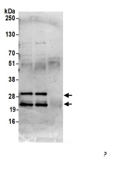 Immunoprecipitation:MEA-1 AntibodyNBP3-30152] -Detection of human MEA1 by western blot of immunoprecipitates. Samples: Whole cell lysate (1.0 mg per IP reaction; 20% of IP loaded) from HeLa cells prepared using NETN lysis buffer. Antibodies: Affinity purified rabbit anti-MEA1 antibody (NBP3-30152 lot 1) used for IP at 6 µg per reaction. MEA1 was also immunoprecipitated by rabbit anti-MEA1.. For blotting immunoprecipitated MEA1, NBP3-30152 was used at 0.4 mg/ml. Detection: Chemiluminescence with an exposure time of 75 seconds.