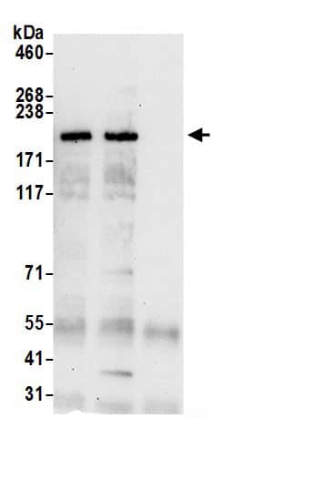 Immunoprecipitation:alpha Desmuslin AntibodyNBP3-30155] -Detection of human SYNM by western blot of immunoprecipitates. Samples: Whole cell lysate (0.5 or 1.0 mg per IP reaction; 20% of IP loaded) from HeLa cells prepared using NETN lysis buffer. Antibodies: Affinity purified rabbit anti-SYNM antibody NBP3-30155 (lot NBP3-30155-1) used for IP at 6 µg per reaction. SYNM was also immunoprecipitated by rabbit anti-SYNM.. For blotting immunoprecipitated SYNM, NBP3-30155 was used at 0.4 µg/ml. Detection: Chemiluminescence with an exposure time of 30 seconds.