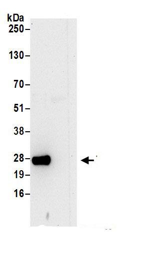 Immunoprecipitation:VBP1 AntibodyNBP3-30158] -Detection of human VBP1 by western blot of immunoprecipitates. Samples: Whole cell lysate (0.5 or 1.0 mg per IP reaction; 20% of IP loaded) from 293T cells prepared using NETN lysis buffer. Antibodies: Affinity purified rabbit anti-VBP1 antibody NBP3-30158 (lot NBP3-30158-1) used for IP at 6 µg per reaction. For blotting immunoprecipitated VBP1, NBP3-30158 was used at 1 µg/ml. Detection: Chemiluminescence with an exposure time of 30 seconds.