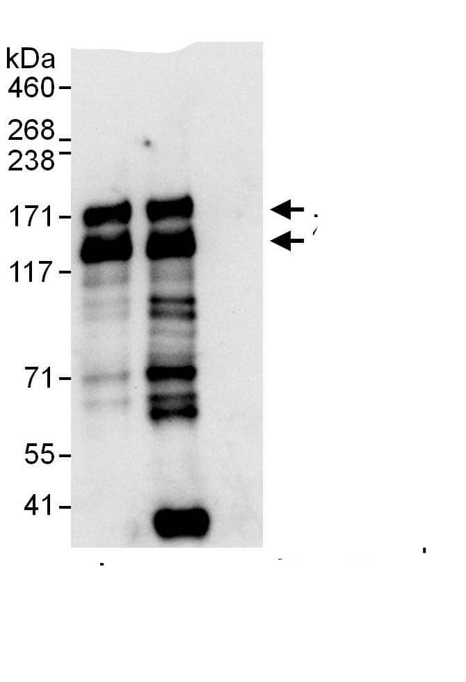 Immunoprecipitation:Tight Junction Protein 2 AntibodyNBP3-30162] -Detection of human ZO-2 by western blot of immunoprecipitates. Samples: Whole cell lysate (1 mg for IP, 20% of IP loaded) from HeLa cells. Antibodies: Affinity purified rabbit anti-ZO-2 antibody NBP3-30162 used for IP at 6 µg/mg lysate. ZO-2 was also immunoprecipitated by rabbit anti-ZO-2., which recognizes a downstream epitope. For blotting immunoprecipitated ZO-2, A303-751A was used at 1 µg/ml. Detection: Chemiluminescence with an exposure time of 10 seconds.