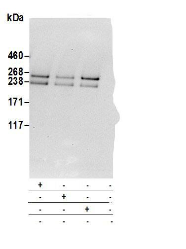 Immunoprecipitation:Neurofibromin 1 AntibodyNBP3-30166] -Detection of human NF1 by western blot of immunoprecipitates. Samples: Whole cell lysate (0.5 or 1.0 mg per IP reaction; 20% of IP loaded) from 293T cells prepared using NETN lysis buffer. Antibodies: Affinity purified rabbit anti-NF1 antibody NBP3-30166 (lot NBP3-30166-1) used for IP at 6 µg per reaction. NF1 was also immunoprecipitated by rabbit anti-NF1 antibodies A304-931A and A300-140A. For blotting immunoprecipitated NF1, NBP3-30166 was used at 1 µg/ml. Detection: Chemiluminescence with an exposure time of 3 minutes.