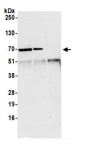 Immunoprecipitation:TBL2 AntibodyNBP3-30167] -Detection of human TBL2 by western blot of immunoprecipitates. Samples: Whole cell lysate (0.5 or 1.0 mg per IP reaction; 20% of IP loaded) from 293T cells prepared using NETN lysis buffer. Antibodies: Affinity purified rabbit anti-TBL2 antibody NBP3-30167 (lot NBP3-30167-1) used for IP at 6 µg per reaction. TBL2 was also immunoprecipitated by rabbit anti-TBL2.. For blotting immunoprecipitated TBL2, A305-081A was used at 0.4 µg/ml. Detection: Chemiluminescence with an exposure time of 3 minutes.