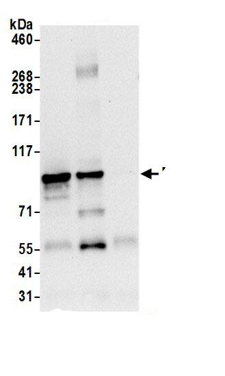 Immunoprecipitation:DIEXF AntibodyNBP3-30168] -Detection of human DIEXF by western blot of immunoprecipitates. Samples: Whole cell lysate (0.5 or 1.0 mg per IP reaction; 20% of IP loaded) from 293T cells prepared using NETN lysis buffer. Antibodies: Affinity purified rabbit anti-DIEXF antibody NBP3-30168 (lot NBP3-30168-1) used for IP at 6 µg per reaction. DIEXF was also immunoprecipitated by rabbit anti-DIEXF.. For blotting immunoprecipitated DIEXF, NBP3-30168 was used at 0.4 µg/ml. Detection: Chemiluminescence with an exposure time of 10 seconds.