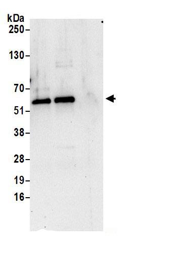 Immunoprecipitation:LMAN1 AntibodyNBP3-30169] -Detection of human LMAN1 by western blot of immunoprecipitates. Samples: Whole cell lysate (0.5 or 1.0 mg per IP reaction; 20% of IP loaded) from 293T cells prepared using NETN lysis buffer. Antibodies: Affinity purified rabbit anti-LMAN1 antibody NBP3-30169 (lot NBP3-30169-1) used for IP at 6 µg per reaction. LMAN1 was also immunoprecipitated by rabbit anti-LMAN1 antibody BL21058. For blotting immunoprecipitated LMAN1, NBP3-30169 was used at 1 µg/ml. Detection: Chemiluminescence with an exposure time of 30 seconds.