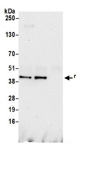 Immunoprecipitation:DRG1 AntibodyNBP3-30170] -Detection of human DRG1 by western blot of immunoprecipitates. Samples: Whole cell lysate (0.5 or 1.0 mg per IP reaction; 20% of IP loaded) from 293T cells prepared using NETN lysis buffer. Antibodies: Affinity purified rabbit anti-DRG1 antibody NBP3-30170 (lot NBP3-30170-1) used for IP at 6 µg per reaction. DRG1 was also immunoprecipitated by rabbit anti-DRG1.. For blotting immunoprecipitated DRG1, NBP3-30170 was used at 1 µg/ml. Detection: Chemiluminescence with an exposure time of 30 seconds.