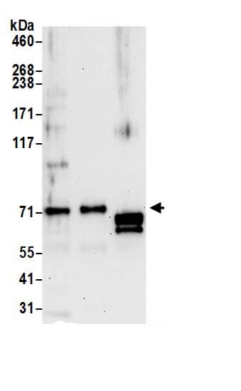 Immunoprecipitation:Epsin-2 AntibodyNBP3-30171] -Detection of human EPN2 by western blot of immunoprecipitates. Samples: Whole cell lysate (0.5 or 1.0 mg per IP reaction; 20% of IP loaded) from HeLa cells prepared using NETN lysis buffer. Antibodies: Affinity purified rabbit anti-EPN2 antibody NBP3-30171 (lot NBP3-30171-1) used for IP at 6 µg per reaction. EPN2 was also immunoprecipitated by rabbit anti-EPN2 antibody BL21886. For blotting immunoprecipitated EPN2, NBP3-30171 was used at 0.4 µg/ml. Detection: Chemiluminescence with an exposure time of 30 seconds.