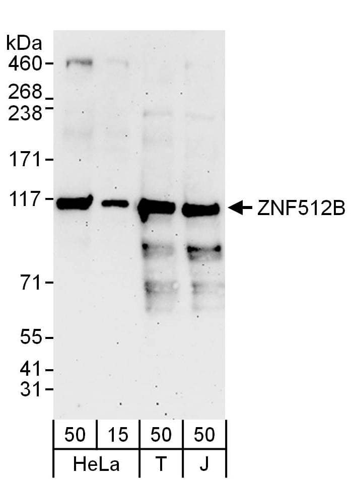 Western Blot:[NBP3-30172]-Detection of human ZNF512B by western blot. Samples: Whole cell lysate from HeLa , HEK293T and Jurkat cells. Antibodies: Affinity purified rabbit anti-ZNF512B antibody used for WB at 0. 1 µg/ml. Detection: Chemiluminescence with an exposure time of 3 minutes.