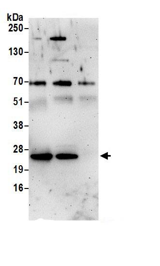 Immunoprecipitation:Rab1A AntibodyNBP3-30173] -Detection of human RAB1A by western blot of immunoprecipitates. Samples: Whole cell lysate (0.5 or 1.0 mg per IP reaction; 20% of IP loaded) from 293T cells prepared using NETN lysis buffer. Antibodies: Affinity purified rabbit anti-RAB1A antibody NBP3-30173 (lot NBP3-30173-1) used for IP at 6 µg per reaction. RAB1A was also immunoprecipitated by rabbit anti-RAB1A.. For blotting immunoprecipitated RAB1A, NBP3-30173 was used at 1 µg/ml. Detection: Chemiluminescence with an exposure time of 3 minutes.