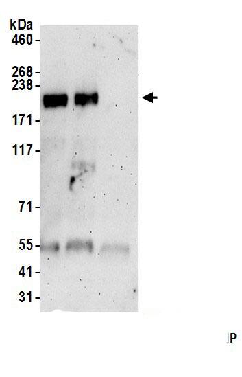 Immunoprecipitation:PLCL3 AntibodyNBP3-30174] -Detection of human PLCH1 by western blot of immunoprecipitates. Samples: Whole cell lysate (0.5 or 1.0 mg per IP reaction; 20% of IP loaded) from 293T cells prepared using NETN lysis buffer. Antibodies: Affinity purified rabbit anti-PLCH1 antibody (NBP3-30174 lot 1) used for IP at 6 µg per reaction. PLCH1 was also immunoprecipitated by rabbit anti-PLCH1 antibody. For blotting immunoprecipitated PLCH1, NBP3-30174 was used at 0.4 mg/ml. Detection: Chemiluminescence with an exposure time of 3 minutes.