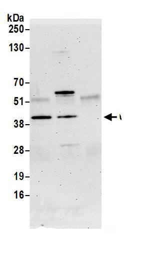 Immunoprecipitation:UBL7 AntibodyNBP3-30180] -Detection of human UBL7 by western blot of immunoprecipitates. Samples: Whole cell lysate (1.0 mg per IP reaction; 20% of IP loaded) from HeLa cells prepared using NETN lysis buffer. Antibodies: Affinity purified rabbit anti-UBL7 antibody NBP3-30180 (lot NBP3-30180-2) used for IP at 3 µg per reaction. UBL7 was also immunoprecipitated by rabbit anti-UBL7.. For blotting immunoprecipitated UBL7, NBP3-30180 was used at 1 µg/ml. Detection: Chemiluminescence with an exposure time of 75 seconds.