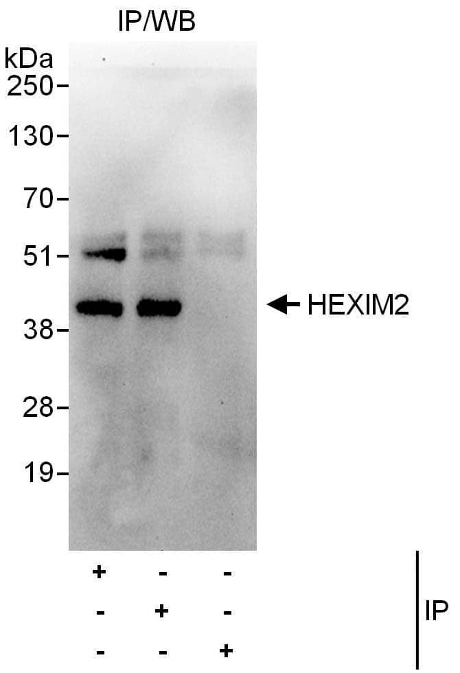 Immunoprecipitation:[NBP3-30181]-Detection of human HEXIM2 by western blot of immunoprecipitates. Samples: Whole cell lysate from HeLa cells. Antibodies: Affinity purified rabbit anti-HEXIM2 antibody used for IP at 6 µg/mg lysate. HEXIM2 was also immunoprecipitated by rabbit anti-HEXIM2 antibody , which recognizes a downstream epitope. For blotting immunoprecipitated HEXIM2, was used at 1 µg/ml. Detection: Chemiluminescence with an exposure time of 30 seconds.