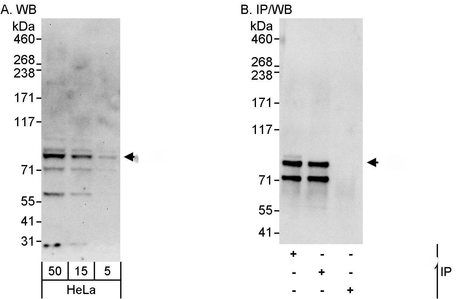 Western Blot:[NBP3-30182]-Detection of human Cul2 by western blot and immunoprecipitation. Samples: Whole cell lysate from HeLa cells. Antibodies: Affinity purified rabbit anti-Cul2 antibody used for WB at 0. 1 µg/ml and 1 µg/ml and used for IP at 3 µg/mg lysate. Cul2 was also immunoprecipitated by rabbit anti-Cul2 antibody , which recognizes an upstream epitope. Detection: Chemiluminescence with exposure times of 30 seconds and 3 seconds.