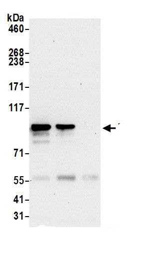 Immunoprecipitation:DIEXF AntibodyNBP3-30185] -Detection of human DIEXF by western blot of immunoprecipitates. Samples: Whole cell lysate (0.5 or 1.0 mg per IP reaction; 20% of IP loaded) from 293T cells prepared using NETN lysis buffer. Antibodies: Affinity purified rabbit anti-DIEXF antibody NBP3-30185 (lot NBP3-30185-1) used for IP at 6 µg per reaction. DIEXF was also immunoprecipitated by rabbit anti-DIEXF.. For blotting immunoprecipitated DIEXF, NBP3-30185 was used at 0.4 µg/ml. Detection: Chemiluminescence with an exposure time of 30 seconds.