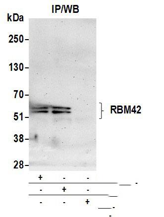 Immunoprecipitation RBM42 Antibody - BSA Free