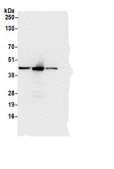 Immunoprecipitation:Adenosine Deaminase/ADA AntibodyNBP3-30187] -Detection of human ADA by western blot of immunoprecipitates. Samples: Whole cell lysate (0.5 or 1.0 mg per IP reaction; 20% of IP loaded) from Jurkat cells prepared using NETN lysis buffer. Antibodies: Affinity purified rabbit anti-ADA antibody NBP3-30187 (lot NBP3-30187-1) used for IP at 6 µg per reaction. ADA was also immunoprecipitated by a rabbit anti-ADA antibodies . For blotting immunoprecipitated ADA, NBP3-30187 was used at 0.4 µg/ml. Detection: Chemiluminescence with an exposure time of 3 seconds.