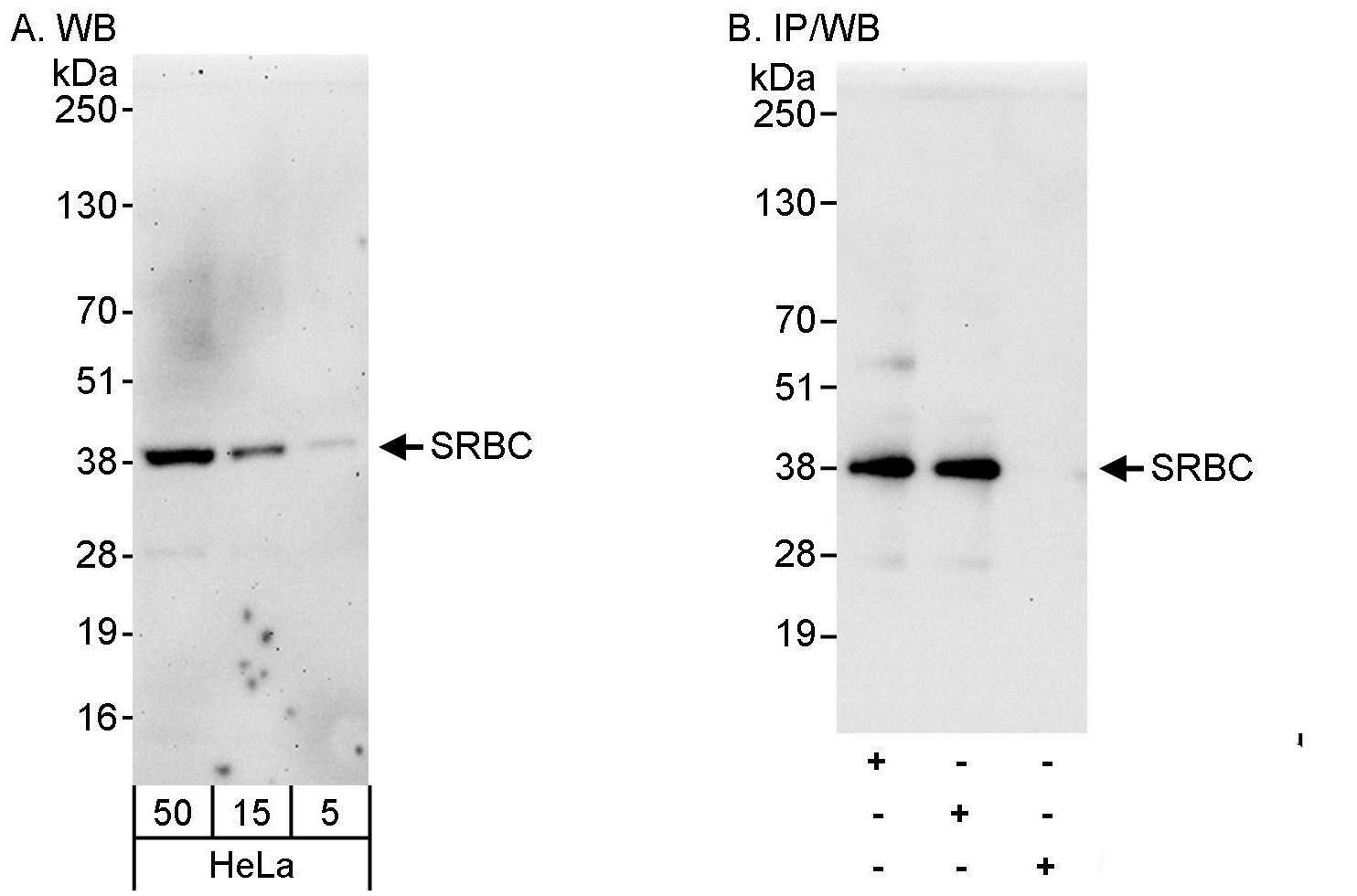 Western Blot:[NBP3-30188]-Detection of human SRBC by western blot and immunoprecipitation. Samples: Whole cell lysate from HeLa cells. Antibodies: Affinity purified rabbit anti-SRBC antibody used for WB at 0. 04 µg/ml and 1 µg/ml and used for IP at 3 µg/mg lysate. SRBC was also immunoprecipitated by rabbit anti-SRBC antibody , which recognizes a downstream epitope. Detection: Chemiluminescence with exposure times of 3 minutes and 10 seconds.