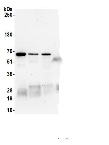 Immunoprecipitation:ASC1 AntibodyNBP3-30189] -Detection of human TRIP4/ASC-1 by western blot of immunoprecipitates. Samples: Whole cell lysate (1.0 mg per IP reaction; 20% of IP loaded) from HEK293T cells prepared using NETN lysis buffer. Antibodies: Affinity purified rabbit anti-TRIP4/ASC-1 antibody (NBP3-30189 lot 4) used for IP at 6 µg per reaction. TRIP4/ASC-1 was also immunoprecipitated by a previous lot of this antibody (NBP3-30189 lot 3) and a second.inst a different epitope of TRIP4/ASC-1 (A300-203A). For blotting immunoprecipitated TRIP4/ASC-1, NBP3-30189 was used at 0.1 µg/ml. Detection: Chemiluminescence with an exposure time of 30 seconds.