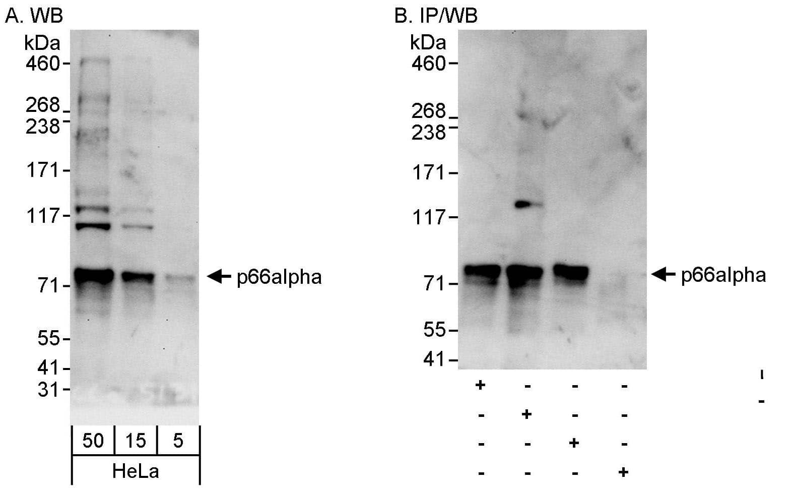 Western Blot:[NBP3-30190]-Detection of human p66alpha by western blot and immunoprecipitation. Samples: Whole cell lysate from HeLa cells. Antibodies: Affinity purified rabbit antibody used for WB at 0. 1 µg/ml and 1 µg/ml and used for IP at 10 µg/mg lysate. p66alpha was also immunoprecipitated by rabbit antibodies and , which recognize other epitopes. Detection: Chemiluminescence with exposure times of 30 seconds and 10 seconds.