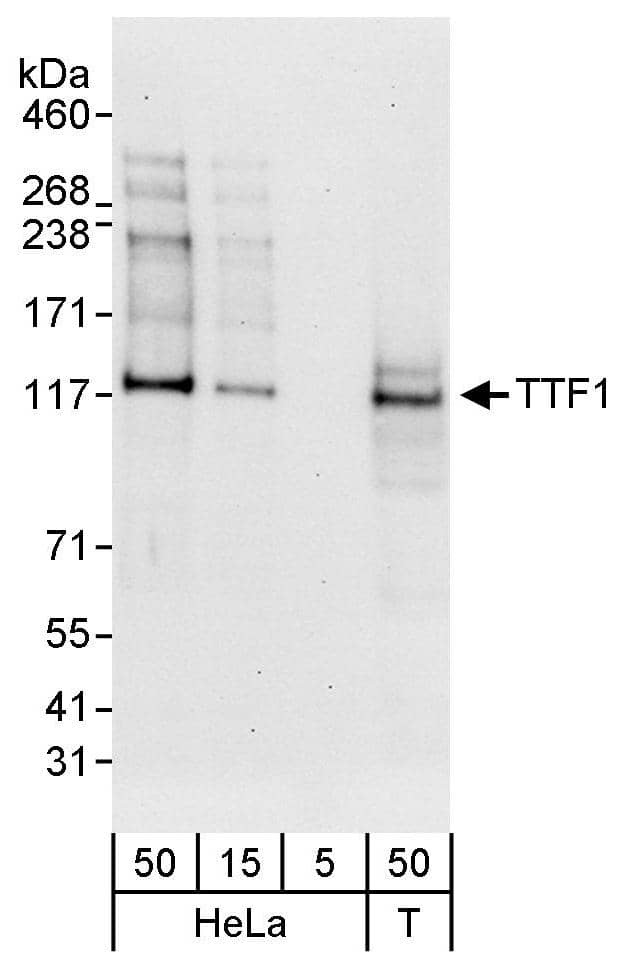 Western Blot:[NBP3-30191]-Detection of human TTF1 by western blot. Samples: Whole cell lysate from HeLa and HEK293T cells. Antibodies: Affinity purified rabbit anti-TTF1 antibody used for WB at 0. 04 µg/ml. Detection: Chemiluminescence with an exposure time of 30 seconds.