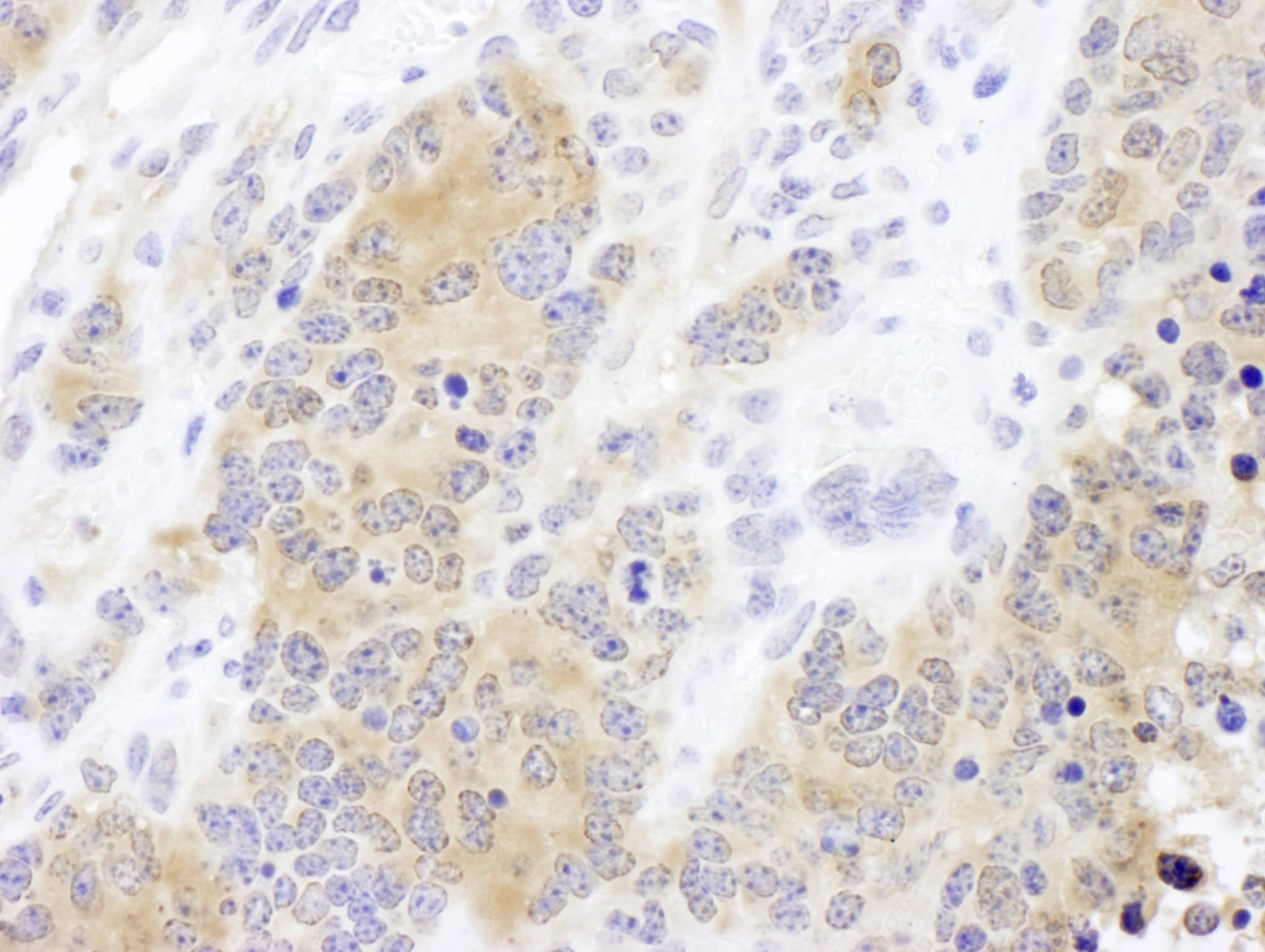 Immunohistochemistry:[NBP3-30192]-Detection of mouse CCT2 by immunohistochemistry. Sample: FFPE section of mouse teratoma. Antibody: Affinity purified rabbit anti-CCT2 used at a dilution of 1: 200. Detection: DAB