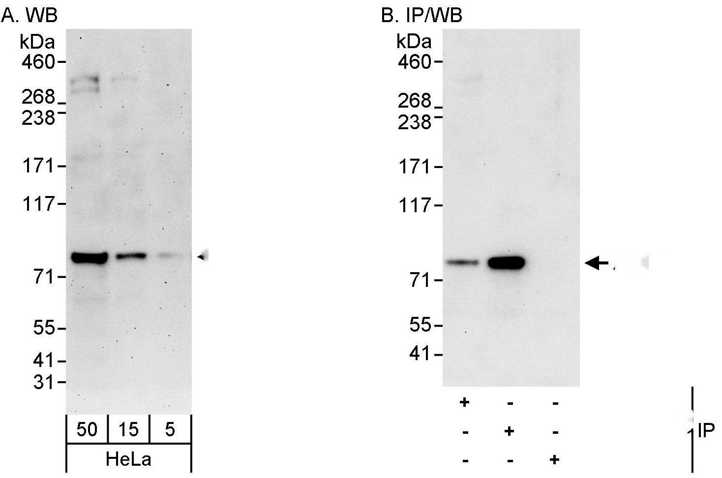 Western Blot:[NBP3-30193]-Detection of human ABCF3 by western blot and immunoprecipitation. Samples: Whole cell lysate from HeLa cells. Antibodies: Affinity purified rabbit anti-ABCF3 antibody used for WB at 0. 04 µg/ml and 0. 4 µg/ml and used for IP at 3 µg/mg lysate. ABCF3 was more efficiently immunoprecipitated by rabbit anti-ABCF3 antibody , which recognizes a downstream epitope. Detection: Chemiluminescence with exposure times of 3 minutes and 30 seconds.