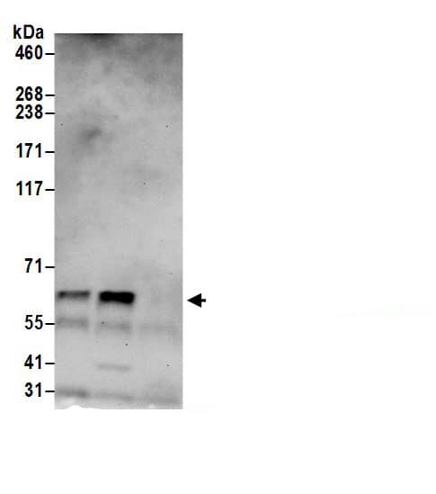 Immunoprecipitation:Thioredoxin Reductase 1/TRXR1 AntibodyNBP3-30194] -Detection of human Thioredoxin Reductase 1 by western blot of immunoprecipitates. Samples: Whole cell lysate (0.5 or 1.0 mg per IP reaction; 20% of IP loaded) from HeLa cells prepared using NETN lysis buffer. Antibodies: Affinity purified rabbit anti-Thioredoxin Reductase 1 antibody NBP3-30194 (lot NBP3-30194-1) used for IP at 6 µg per reaction. Thioredoxin Reductase 1 was also immunoprecipitated by rabbit anti-Thioredoxin Reductase 1 antibody BL18351. For blotting immunoprecipitated Thioredoxin Reductase 1, NBP3-30194 was used at 1 µg/ml. Detection: Chemiluminescence with an exposure time of 30 seconds.