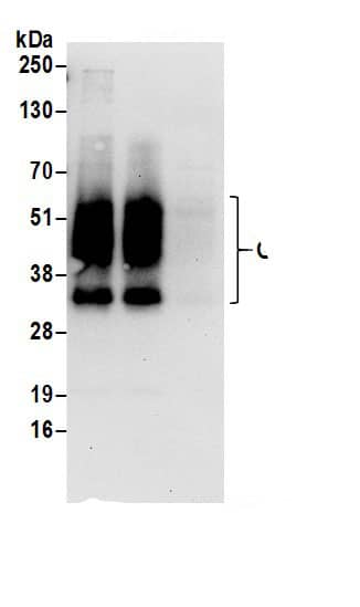 Immunoprecipitation:GPRC5A/RAI3 AntibodyNBP3-30195] -Detection of human GPRC5A by western blot of immunoprecipitates. Samples: Whole cell lysate (1 mg for IP; 20% of IP loaded) prepared using NETN buffer from HeLa cells. Antibodies: Affinity purified rabbit anti-GPRC5A antibody NBP3-30195 (lot NBP3-30195-1) used for IP at 6 µg per reaction. GPRC5A was also immunoprecipitated by rabbit anti-GPRC5A.. For blotting immunoprecipitated GPRC5A, NBP3-30195 was used at 0.4 µg/ml. Detection: Chemiluminescence with an exposure time of 30 seconds.